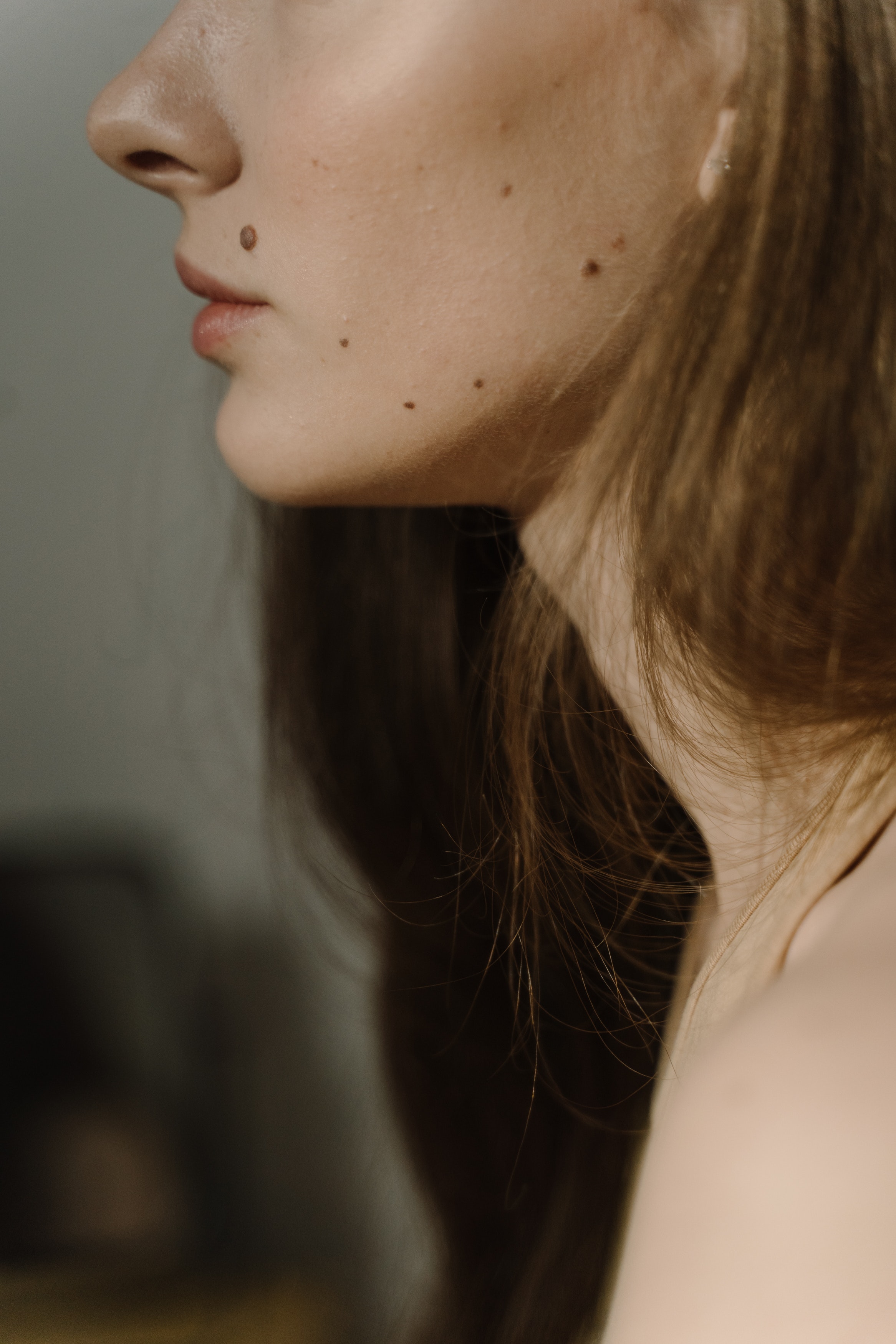 mole removal in Harrogate