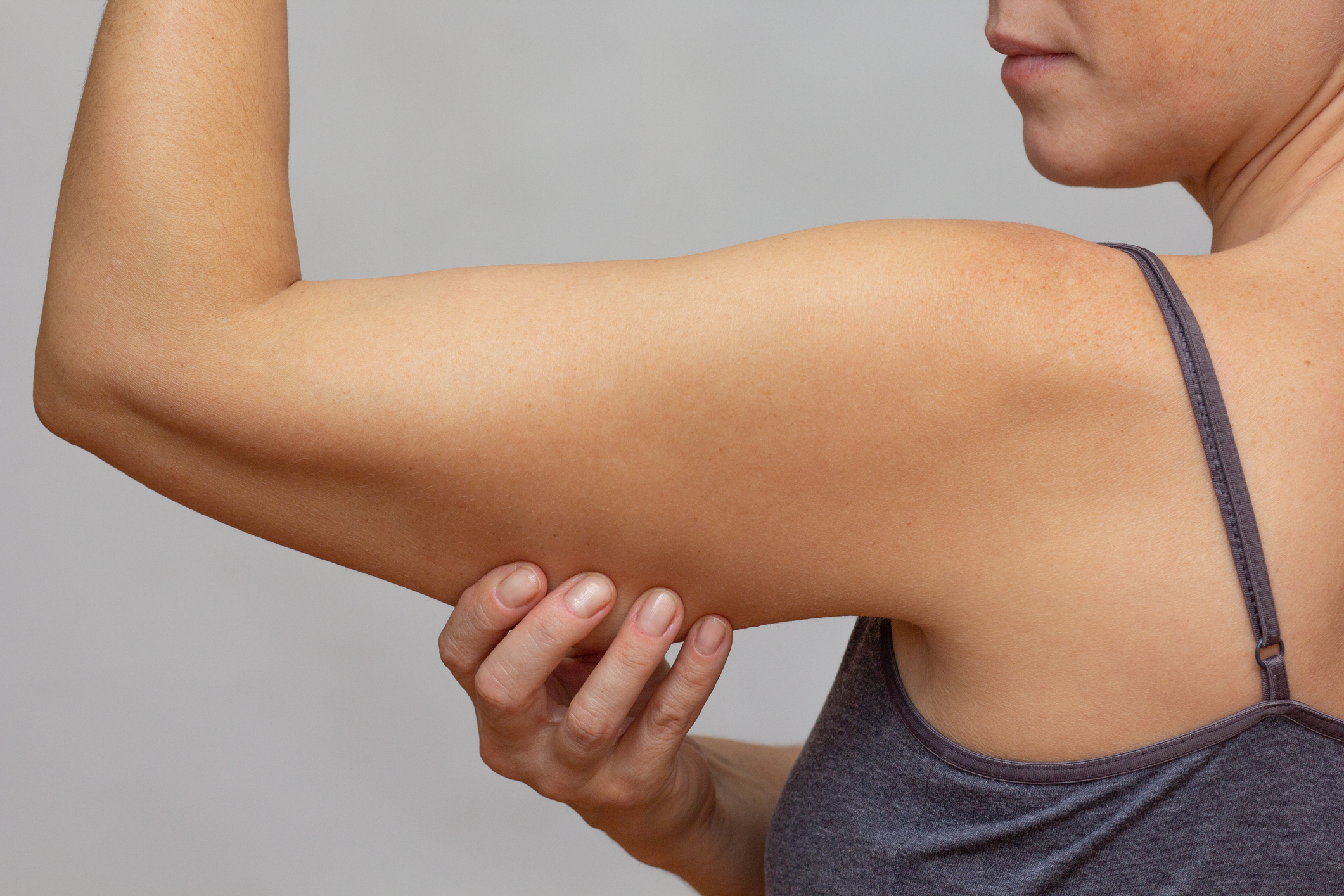 Cropped woman body showing arm with loose skin on grey background
