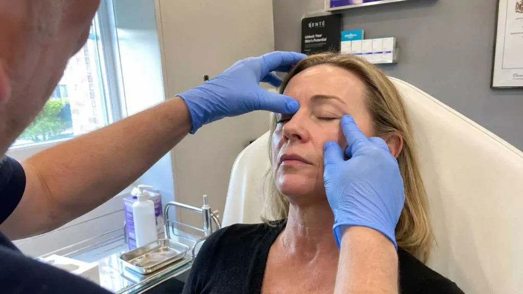 upper eyelid blepharoplasty in Harrogate