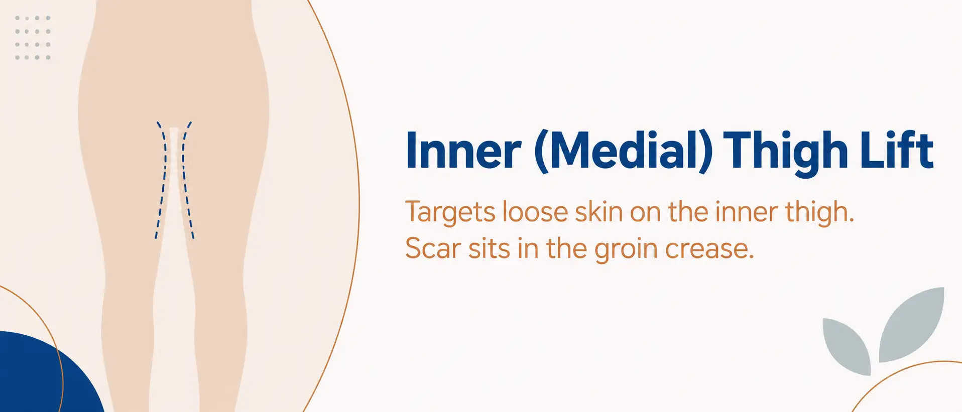 Medial (inner) thigh lift